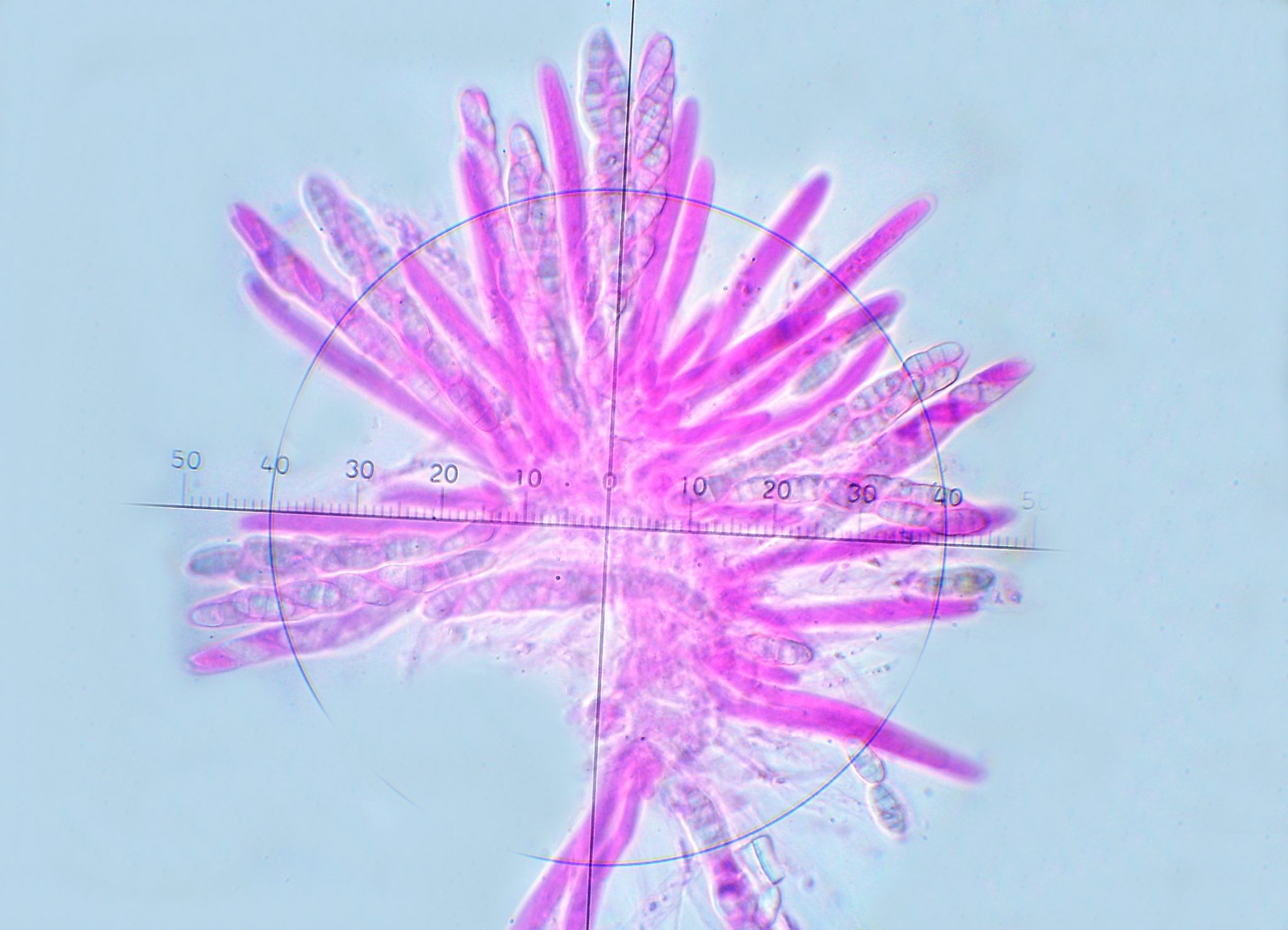 Seimatosporium lichenicola (Corda) Shoemaker & E. Müll. 1965